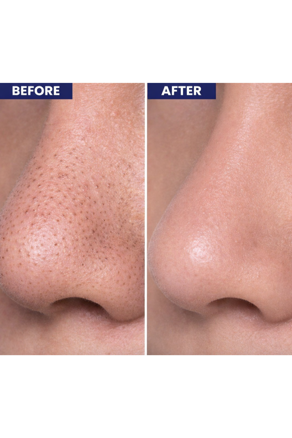 KRASA JASNY CLEAR SKIN FACE SERUM