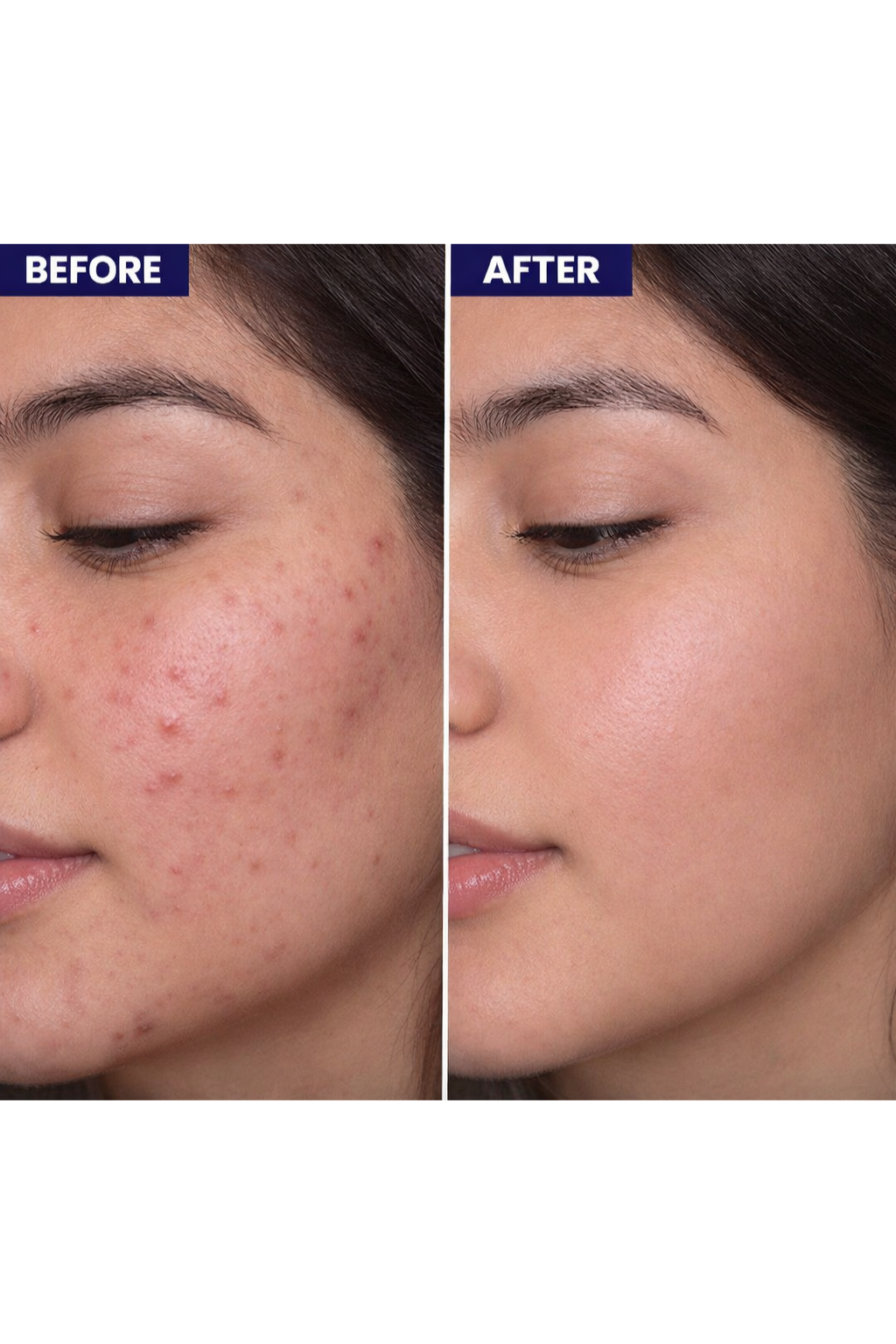 KRASA JASNY CLEAR SKIN FACE SERUM